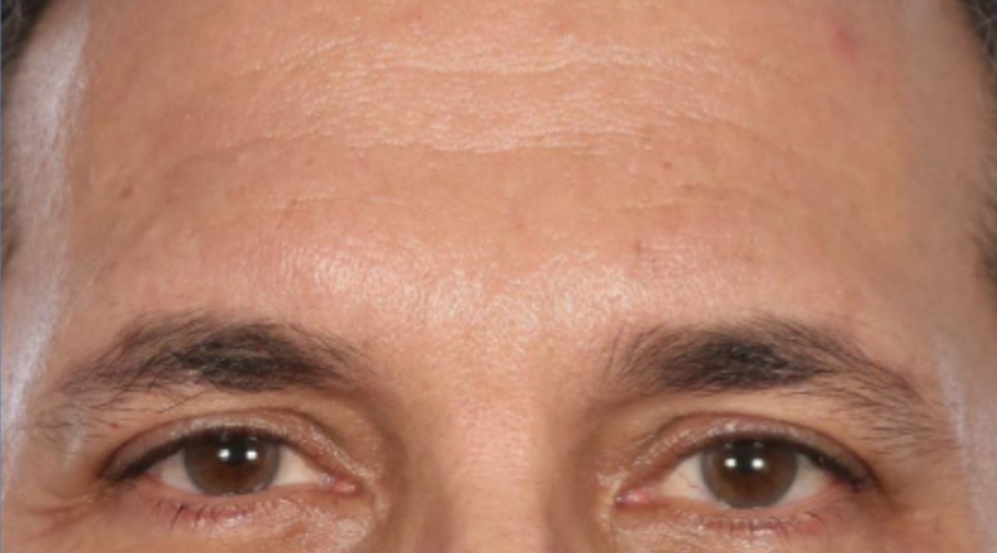 After 30 Days